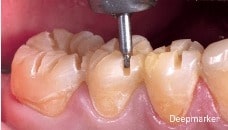 Dr Olivier Etienne Occlushaper