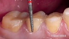 Dr Olivier Etienne Fraise 6844