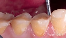 Dr Olivier Etienne Fraise 10839