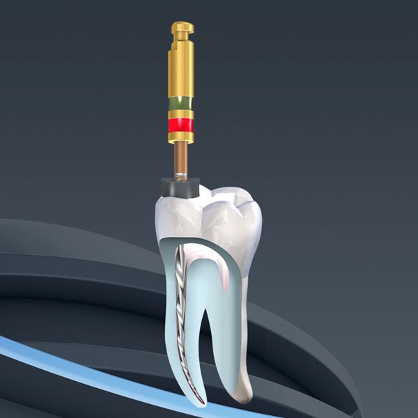 Procodile Q (asymétrique alternatif)