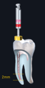 RE05-2-min.png